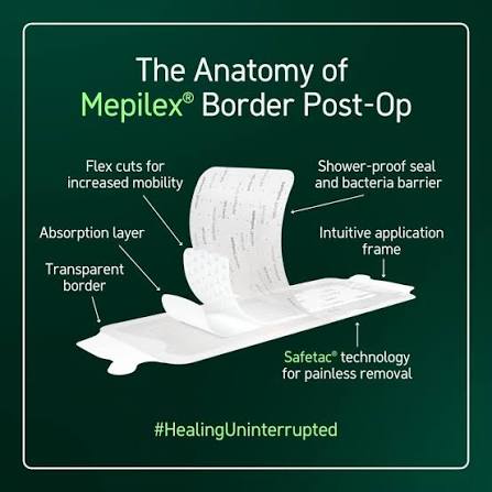 Mölnlycke Mepilex Border Post-Op - 10x25 cm - Image 3